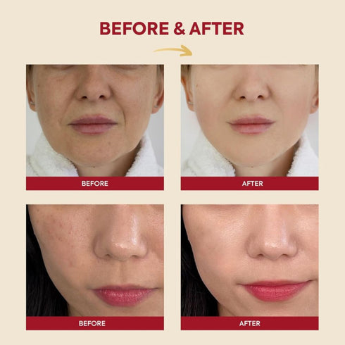 Essence : Snail Mucin 97% + Rice 100ml