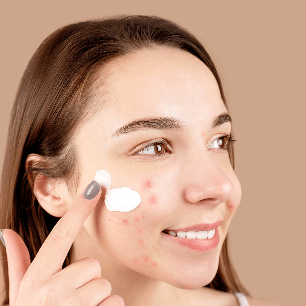 How do I choose the right cosmetic products for acne prone skin?