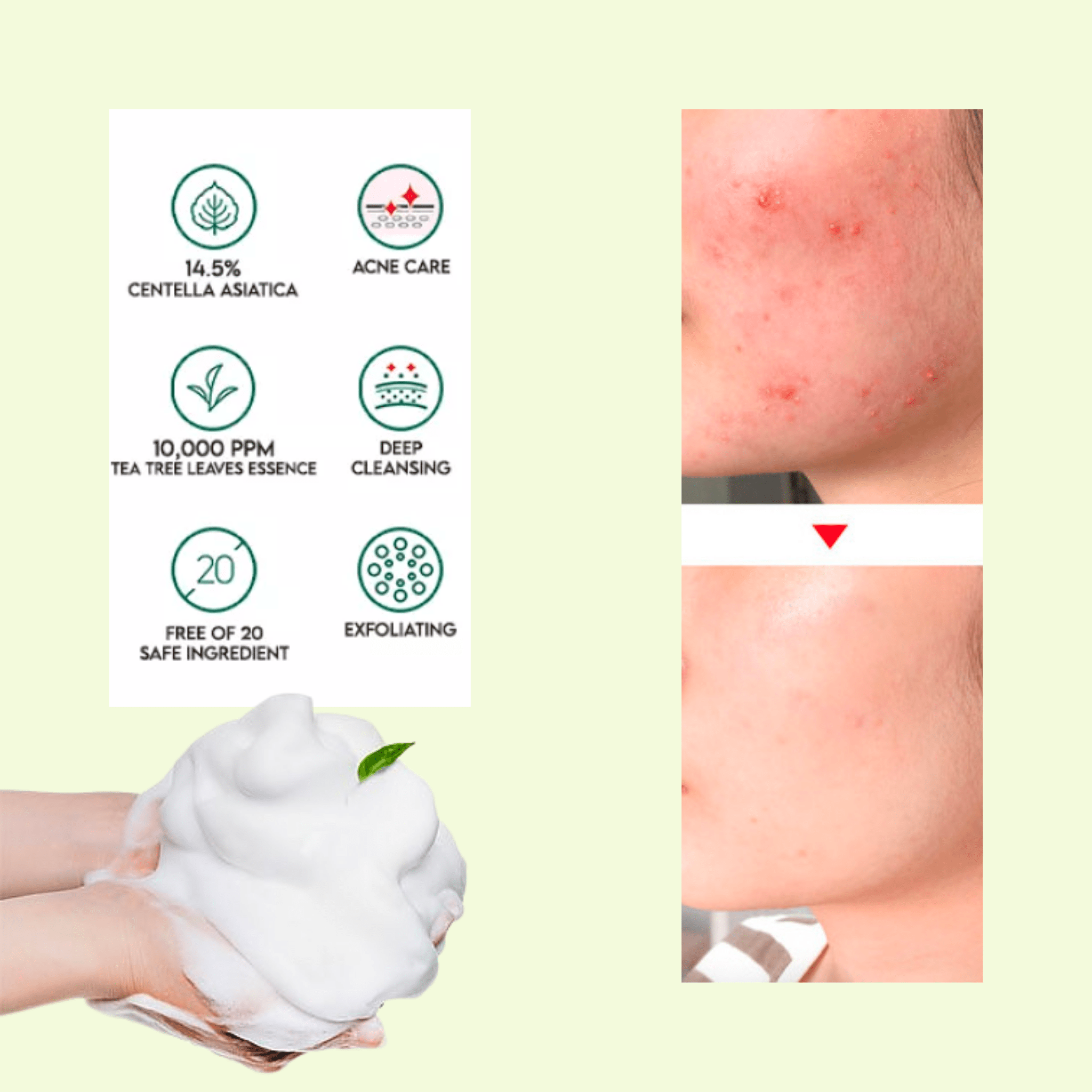 Some By Mi AHA BHA PHA Miracle Acne Clear Foam