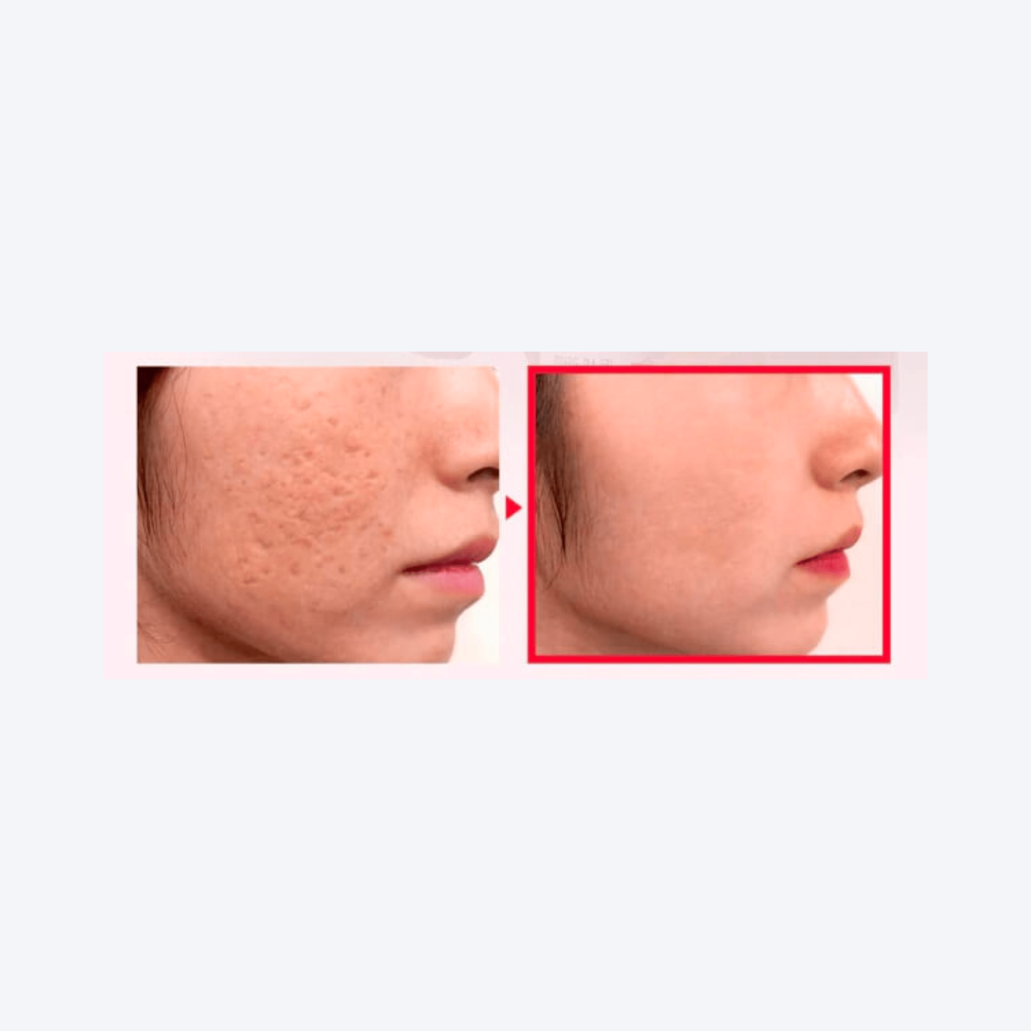 Some by Mi Snail TrueCICA Miracle Repair Serum